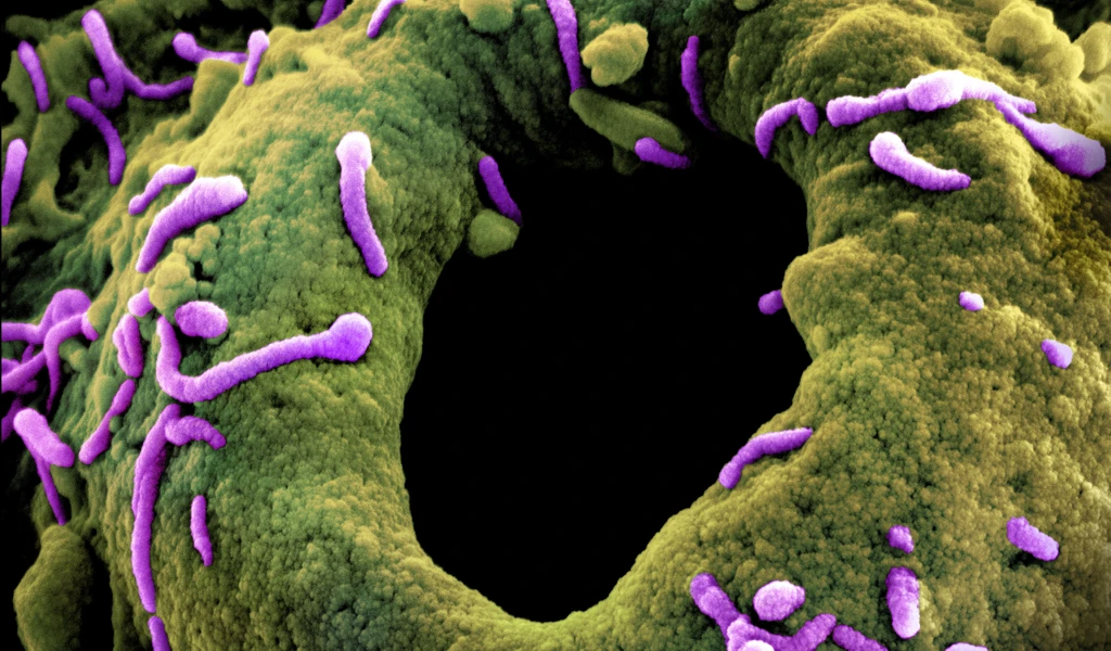 Marburg virus, Image captured at the NIAID Integrated Research Facility in Fort Detrick, Maryland. Credit: NIAID