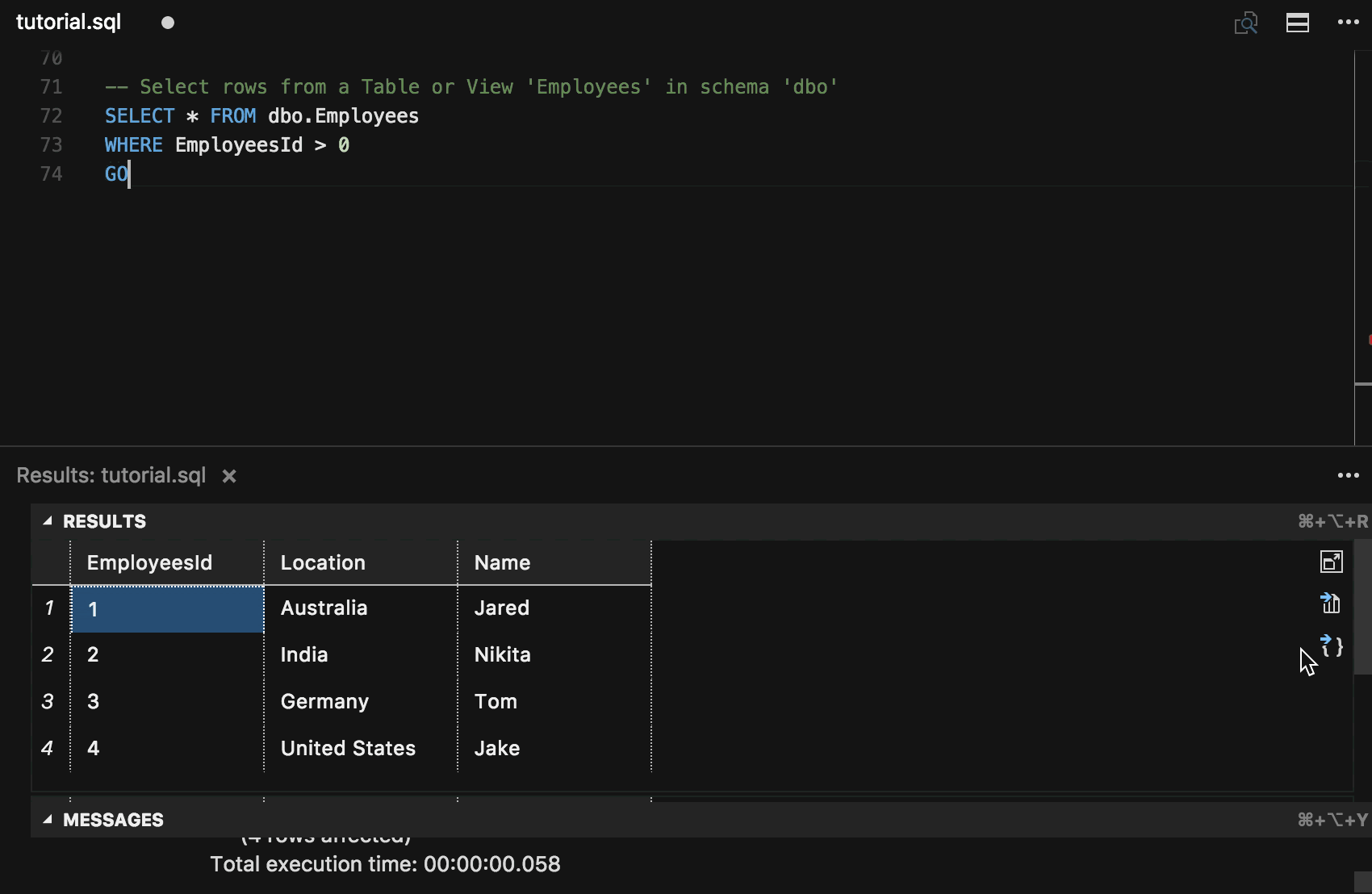 save tsql