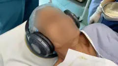 दिल्लीस्थित एक अस्पतालमा सर्जरी भइरहेका बिरामीको कानमा हेडफोन लगाएर सङ्गीत सुनाइँदै